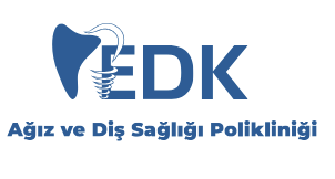 EDK